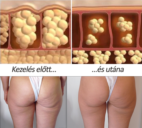 albanner_kezeles
